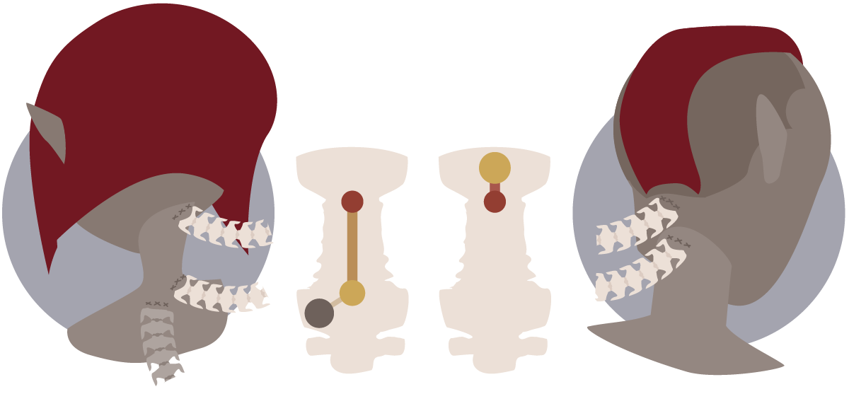 Lerna spine implants