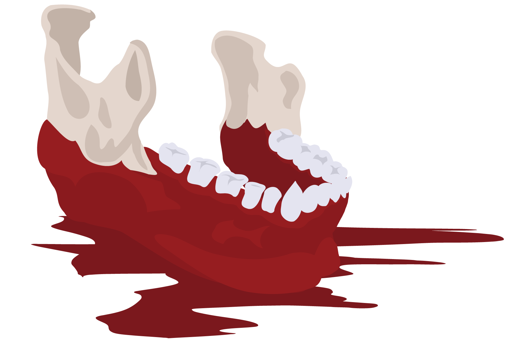The jawbone of Dinky Luckless